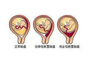 西安女子医院做妇科检查_天佑妇产医院怎么样_天佑妇产女子医院_西安女子医院_天佑妇产医院月经不调_天佑妇产医院无痛人流_小寨妇产医院